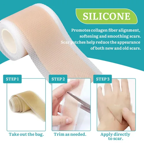Vista 6 de Hojas de silicona para cicatrices, cinta de silicona para cicatrices, rollo profesional suave de tiras de silicona para cicatrices, hojas